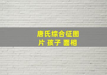 唐氏综合征图片 孩子 面相